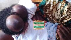 20-year-old woman gives birth to baby with two heads at Swedru