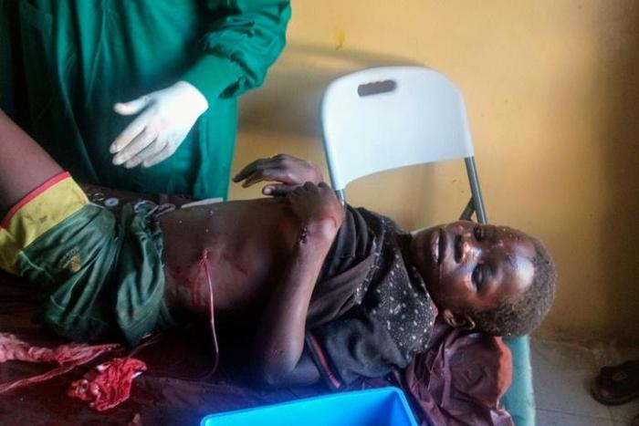 More than 40 people were injured in the triple suicide bombing in northeast Nigeria's Borno state that claimed 30 lives
