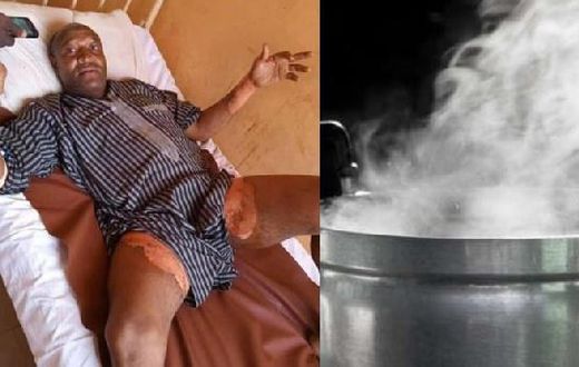 Woman baths husband with hot water