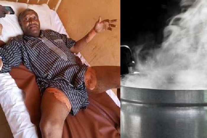 Woman baths husband with hot water