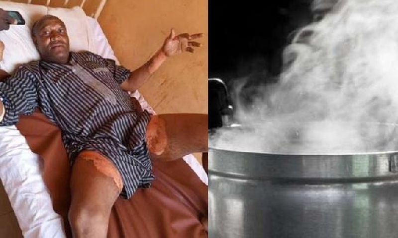 Woman baths husband with hot water