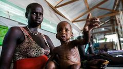 Millions of people are facing severe hunger in South Sudan as a result of the country's disastrous civil war