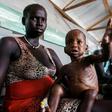 Millions of people are facing severe hunger in South Sudan as a result of the country's disastrous civil war