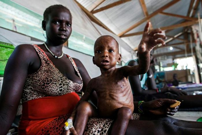 Millions of people are facing severe hunger in South Sudan as a result of the country's disastrous civil war