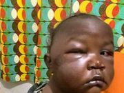 Heartless father brutalises 1-year-old daughter out of anger