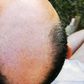 7 Ways to Slow Down Hair Loss