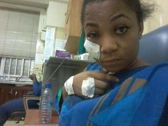 Photo of assaulted Vicky Zugah