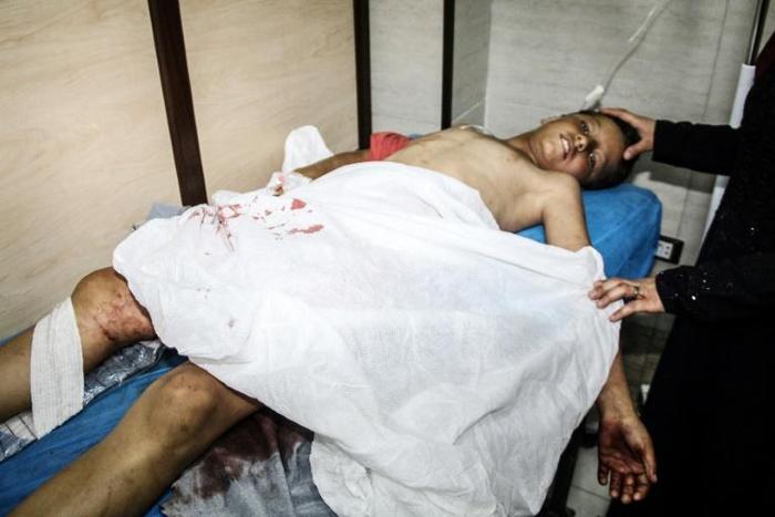 A handout picture released by the official Syrian Arab News Agency (SANA) on July 14, 2019, shows a wounded civilian lying on a hospital bed following a rocket attack in the government-held northern city of Aleppo. Rockets fired by jihadists today kill...
