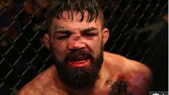 Mike Perry suffered a horrific nose injury in a loss to Vicente Luque                   Credit: Getty - Contributor