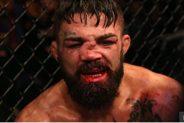 Mike Perry suffered a horrific nose injury in a loss to Vicente Luque                   Credit: Getty - Contributor