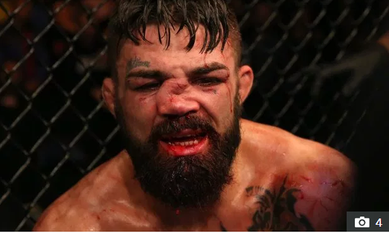 Mike Perry suffered a horrific nose injury in a loss to Vicente Luque                   Credit: Getty - Contributor