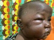 Heartless father brutalises 1-year-old daughter out of anger