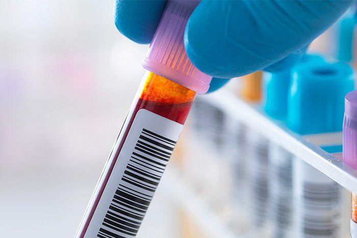 5 Questions You Should Ask About Your Test Results