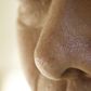 Dr. Pimple Popper Reshaped a Man's Nose