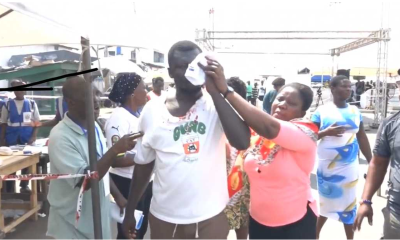 Man sustains injury in Odododiodio