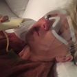 Watch Taylor Swift On Pain Meds After Lasik