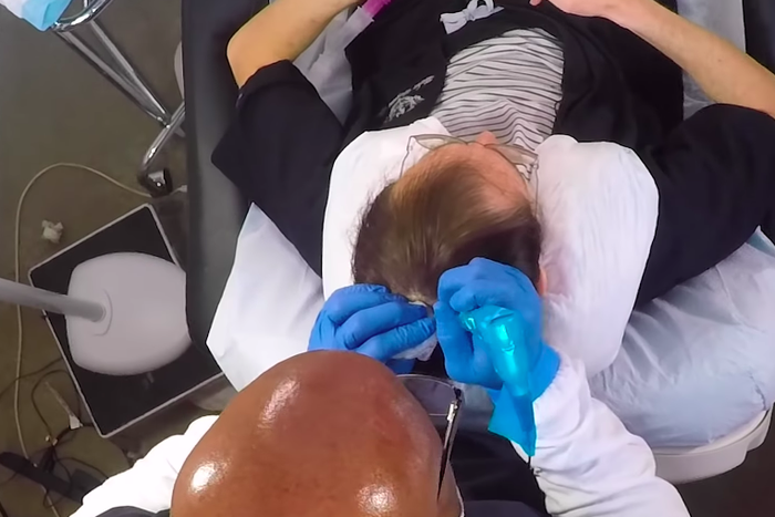 This Guy Tattooed His Scalp to Hide His Baldness