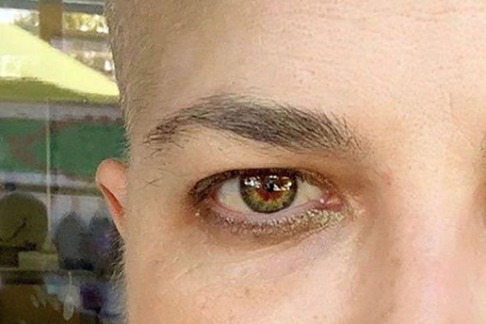 Selma Blair Says She's Got 'Peach Fuzz'