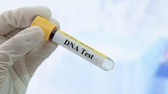 DNA TEST