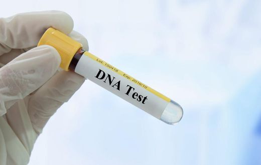 DNA TEST