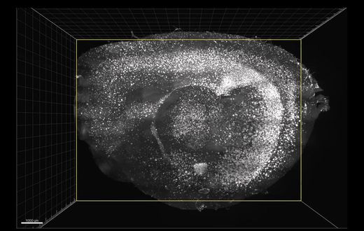 Flashing Lights and Sounds Improve Memory and Learning Skills in Mice