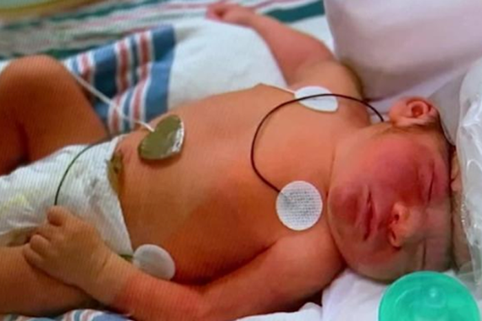 New Jersey Baby Survives Rare Diagnosis