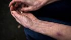 At 71, She's Never Felt Pain or Anxiety. Now Scientists Know Why.