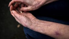 At 71, She's Never Felt Pain or Anxiety. Now Scientists Know Why.