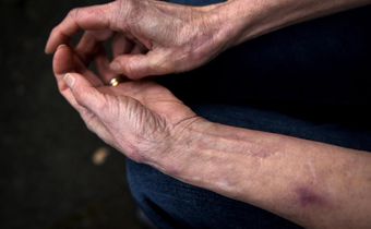 At 71, She's Never Felt Pain or Anxiety. Now Scientists Know Why.