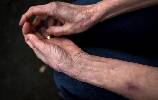 At 71, She's Never Felt Pain or Anxiety. Now Scientists Know Why.