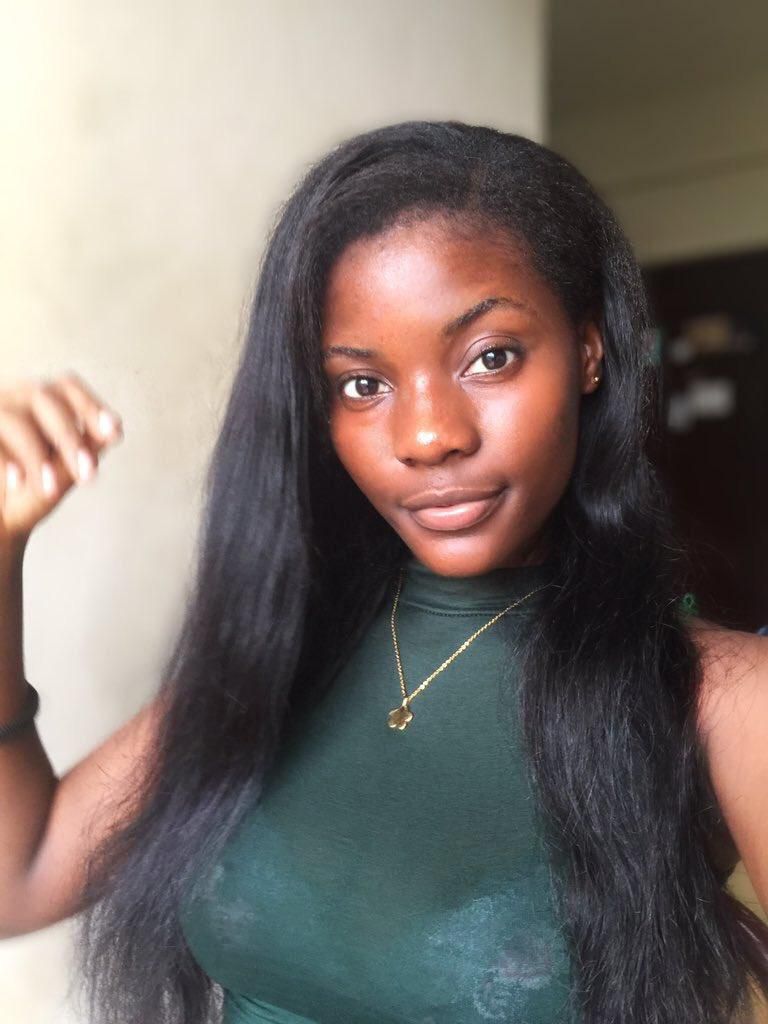 Karen: See photos of Legon student who assaulted her boyfriend