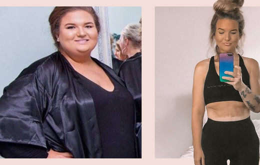 'I Lost 189 Pounds And My Life Completely Changed'