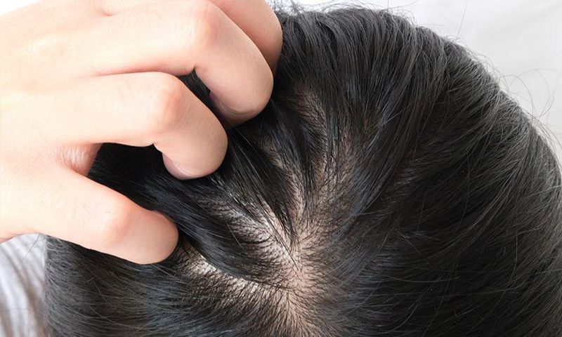 14 Best Shampoos For Thinning Hair