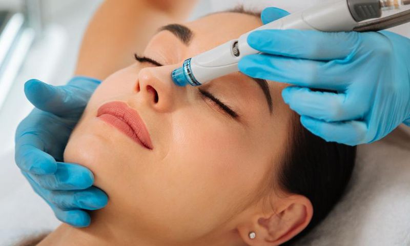 Say Goodbye to Blackheads with a Hydrafacial