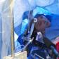 In this October 29, 2019, still image taken from a video courtesy of Methodist Dallas Medical Center in Dallas, Texas, Jenna Schardt, 25, remains conscious while neurosurgeons perform brain surgery