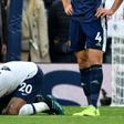 Dele Alli needs people to rally round him if he is to enjoy a resurgence in his form says Tottenham Hotspur manager Mauricio Pochettino