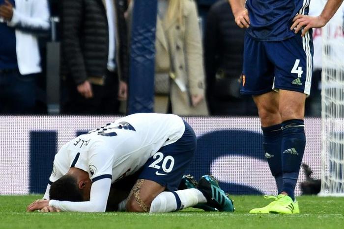 Dele Alli needs people to rally round him if he is to enjoy a resurgence in his form says Tottenham Hotspur manager Mauricio Pochettino