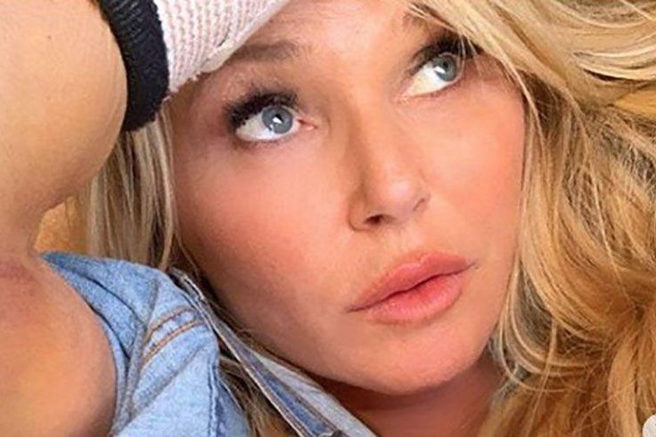 Christie Brinkley Just Posted Her X-Ray Photos