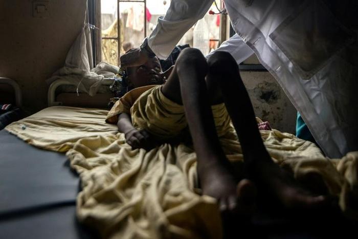 A doctor evaluates a patient at the combined medicine and sickle-cell anaemia center on February 3, 2016 at Kinshasa