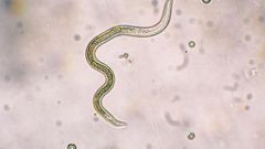 Toxocara canis second stage larvae hatch from eggs