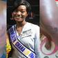 Nana Ama Essien's scars from the shrine brutality