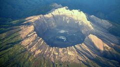 Dr. Pimple Popper Pops A Volcano Arm Cyst