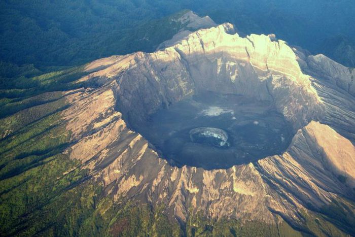 Dr. Pimple Popper Pops A Volcano Arm Cyst