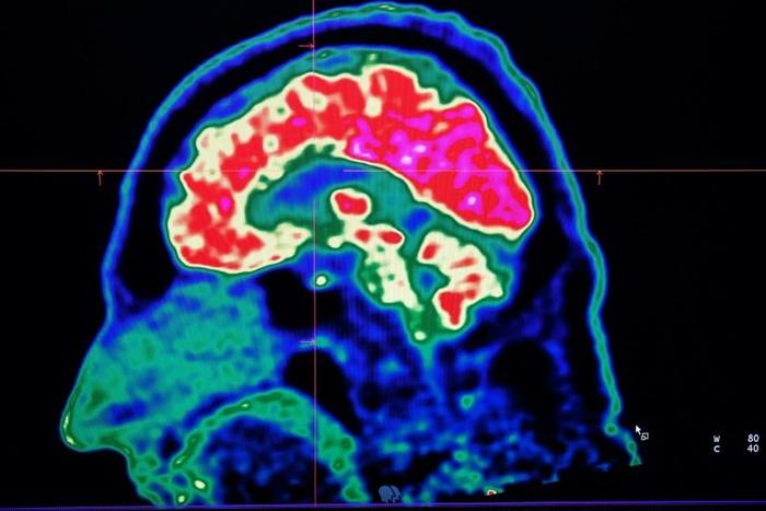 A new study honed in on the brain circuitry responsible for upgrading or downgrading pain signals, likening the mechanism to how a home thermostat controls room temperature
