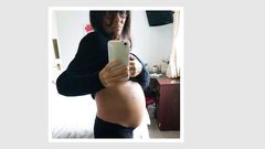 Not Pregnant: Woman Discovers Huge Ovarian Tumors
