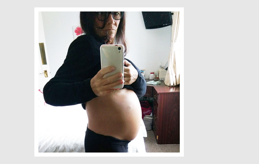 Not Pregnant: Woman Discovers Huge Ovarian Tumors