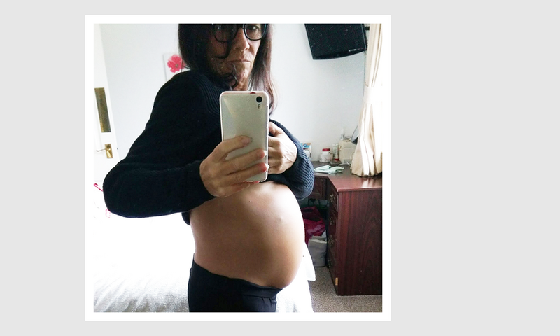Not Pregnant: Woman Discovers Huge Ovarian Tumors