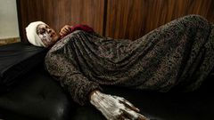 Syrian patient Fatima al-Issa who was hit by shrapnel during Turkish bombardment of Ras al-Ain, rests after receiving treatment at a hospital in the town of Tal Tamr in the countryside of Syria's northeastern Hasakeh province, on October 11, 2019.Ankar...
