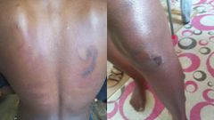Nana Ama Essien's scars from the shrine brutality
