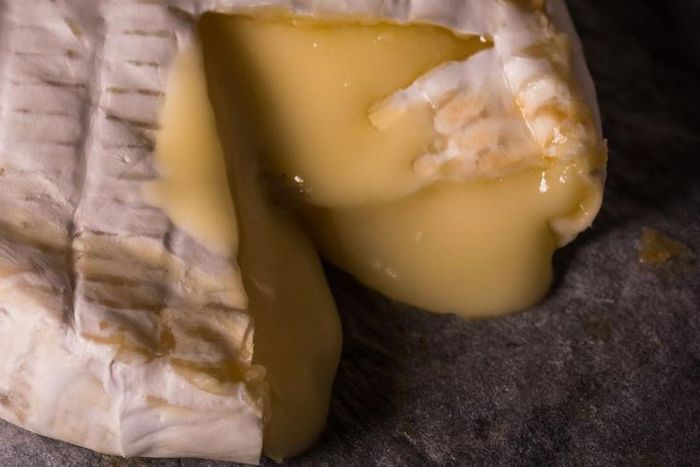 Dr. Pimple Popper Squeezes Cheese Steatocystoma